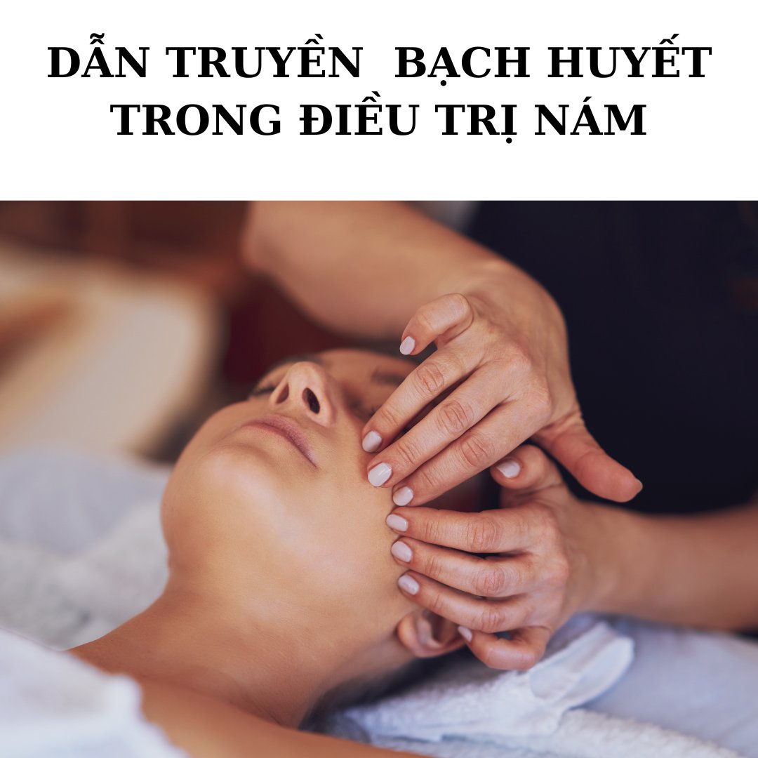 Dẫn truyền hệ bạch huyết trong điều trị nám.